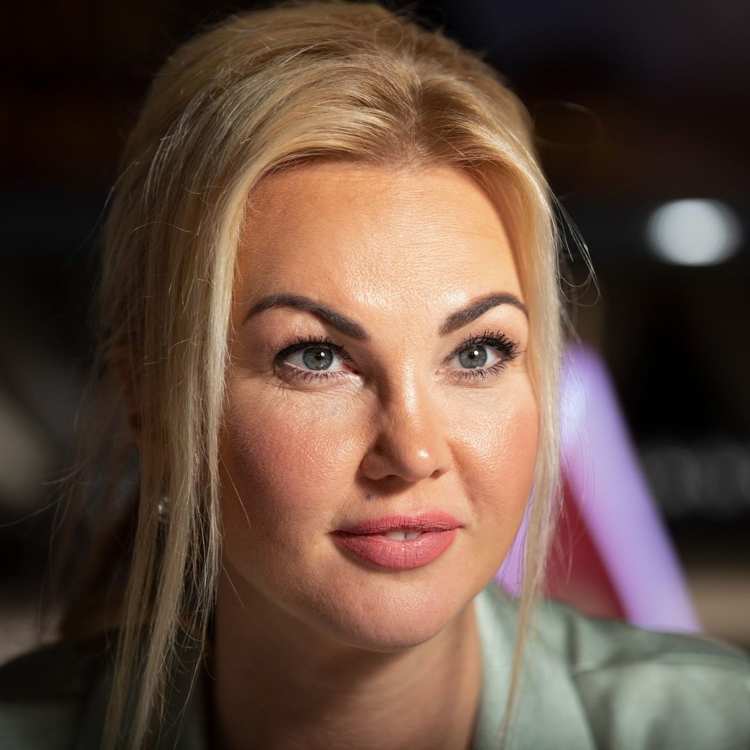 Камалія вперше чесно розповіла про "пластику" обличчя